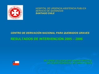 CENTRO DE DERIVACIÓN NACIONAL PARA QUEMADOS GRAVES RESULTADOS DE INTERVENCIÓN 2005 – 2006 DR JORGE VILLEGAS, DRA SANDRA WHITTLE, DR CESAR PEDREROS, DR OMAR ATENAS HOSPITAL DE URGENCIA ASISTENCIA PUBLICA SERVICIO DE QUEMADOS  SANTIAGO CHILE 