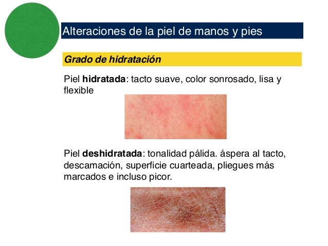 La psoriasis de la parte pilosa de la cabeza las lociones
