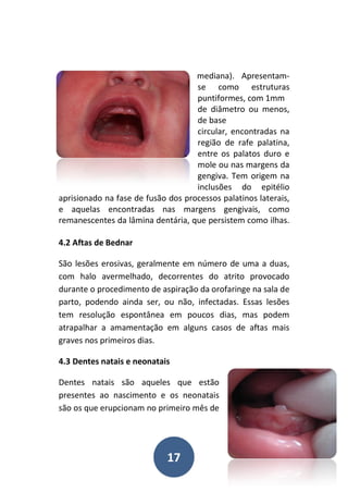 17
mediana). Apresentam-
se como estruturas
puntiformes, com 1mm
de diâmetro ou menos,
de base
circular, encontradas na
região de rafe palatina,
entre os palatos duro e
mole ou nas margens da
gengiva. Tem origem na
inclusões do epitélio
aprisionado na fase de fusão dos processos palatinos laterais,
e aquelas encontradas nas margens gengivais, como
remanescentes da lâmina dentária, que persistem como ilhas.
4.2 Aftas de Bednar
São lesões erosivas, geralmente em número de uma a duas,
com halo avermelhado, decorrentes do atrito provocado
durante o procedimento de aspiração da orofaringe na sala de
parto, podendo ainda ser, ou não, infectadas. Essas lesões
tem resolução espontânea em poucos dias, mas podem
atrapalhar a amamentação em alguns casos de aftas mais
graves nos primeiros dias.
4.3 Dentes natais e neonatais
Dentes natais são aqueles que estão
presentes ao nascimento e os neonatais
são os que erupcionam no primeiro mês de
 