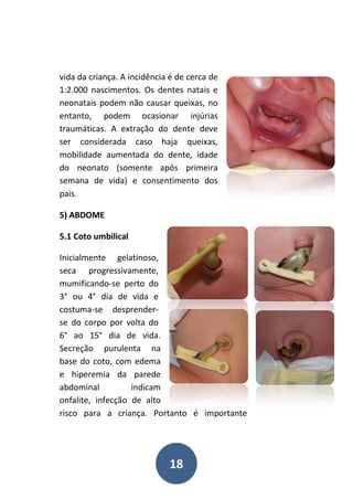 Manual de Alterações Fisiológicas do Recém - Nascido | PDF