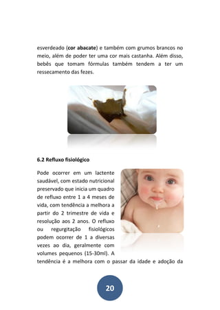 20
esverdeado (cor abacate) e também com grumos brancos no
meio, além de poder ter uma cor mais castanha. Além disso,
bebês que tomam fórmulas também tendem a ter um
ressecamento das fezes.
6.2 Refluxo fisiológico
Pode ocorrer em um lactente
saudável, com estado nutricional
preservado que inicia um quadro
de refluxo entre 1 a 4 meses de
vida, com tendência a melhora a
partir do 2 trimestre de vida e
resolução aos 2 anos. O refluxo
ou regurgitação fisiológicos
podem ocorrer de 1 a diversas
vezes ao dia, geralmente com
volumes pequenos (15-30ml). A
tendência é a melhora com o passar da idade e adoção da
 