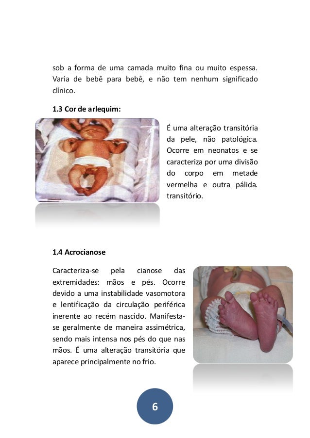 Manual De Alteracoes Fisiologicas Do Recem Nascido