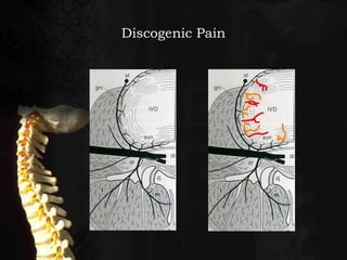 Interventional approach to back pain  dr surange
