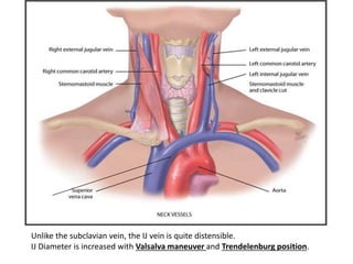 Quite Distensible Interventional nephrology dr ahmed donia | PPTX
