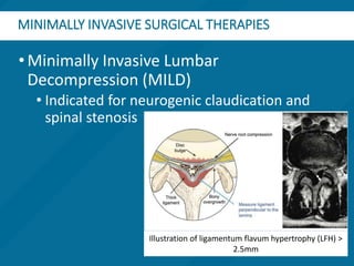 Interventional Pain Management rev. 2021.pptx