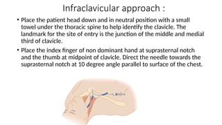 Infraclavicular approach :
• Place the patient head down and in neutral position with a small
towel under the thoracic spine to help identify the clavicle. The
landmark for the site of entry is the junction of the middle and medial
third of clavicle.
• Place the index finger of non dominant hand at suprasternal notch
and the thumb at midpoint of clavicle. Direct the needle towards the
suprasternal notch at 10 degree angle parallel to surface of the chest.
 