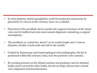 In some patients, mitral regurgitation could be treated percutaneously by placement of a device in the coronary sinus via a catheter.    Placement of the prosthetic device pushes the support structures of the mitral valve and its leaflets back into more normal alignment, mimicking a surgical annuloplasty.  The prosthesis is a metal bar, about 7 cm in usable length and 1.5 mm in diameter, flexible at both ends and stiff in the middle.  Guided by fluoroscopy and transesophageal echocardiography, the bar is positioned within the coronary sinus, near the posterior valve annulus.  By exerting pressure on the dilated annulus and pushing it and its attached leaflet closer toward the other leaflet, the device helps restore more normal valve alignment and hemodynamics.  