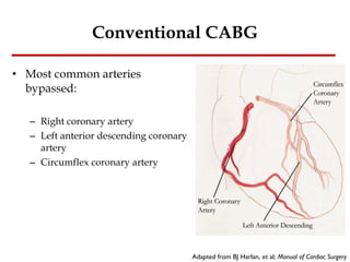 Conventional CABG Most common arteries bypassed: Right coronary artery Left anterior descending coronary artery Circumflex coronary artery Adapted from BJ Harlan, et al;  Manual of Cardiac Surgery 