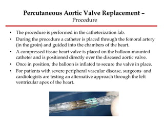 The procedure is performed in the catheterization lab. During the procedure a catheter is placed through the femoral artery (in the groin) and guided into the chambers of the heart.   A compressed tissue heart valve is placed on the balloon-mounted catheter and is positioned directly over the diseased aortic valve.   Once in position, the balloon is inflated to secure the valve in place. For patients with severe peripheral vascular disease, surgeons  and cardiologists are testing an alternative approach through the left ventricular apex of the heart. Percutaneous Aortic Valve Replacement –  Procedure 