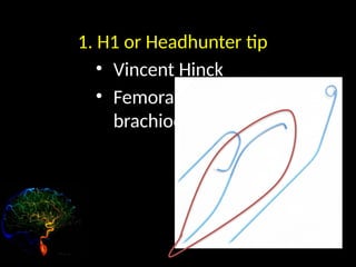 Vincent Roks Headhunter INTERVENTIONAL RADIOGRAPHY introduction.pptx