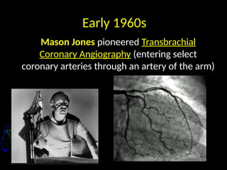 Early 1960s
Mason Jones pioneered Transbrachial
Coronary Angiography (entering select
coronary arteries through an artery of the arm)
 