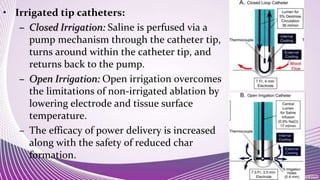 • Irrigated tip catheters:
– Closed Irrigation: Saline is perfused via a
pump mechanism through the catheter tip,
turns around within the catheter tip, and
returns back to the pump.
– Open Irrigation: Open irrigation overcomes
the limitations of non-irrigated ablation by
lowering electrode and tissue surface
temperature.
– The efficacy of power delivery is increased
along with the safety of reduced char
formation.
 