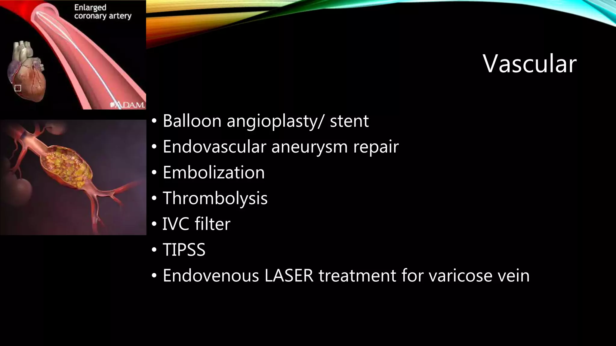 Interventional radiology | PPTX