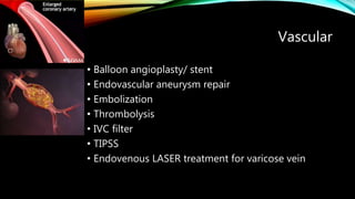 Vascular
• Balloon angioplasty/ stent
• Endovascular aneurysm repair
• Embolization
• Thrombolysis
• IVC filter
• TIPSS
• Endovenous LASER treatment for varicose vein
 