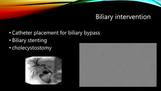 Biliary intervention
• Catheter placement for biliary bypass
• Biliary stenting
• cholecystostomy
 