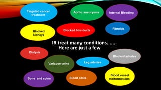 Bone and spine
Leg arteries
Blocked arteries
Internal Bleeding
Targeted cancer
treatment
Dialysis
Blocked bile ducts
Aortic aneurysms
Blood clots
Blood vessel
malformations
Fibroids
Varicose veins
Blocked
kidneys
IR treat many conditions.......
Here are just a few
 