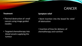 CANCER
Treatment
• Thermal destruction of small
cancers using image guided
needles
• Targeted chemotherapy into
blood vessels supplying the
tumour
Symptom relief
• Stent insertion into the bowel for relief
of obstruction
• Insertion of lines for delivery of
chemotherapy and nutrition
 