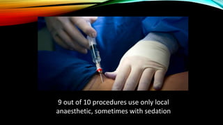 9 out of 10 procedures use only local
anaesthetic, sometimes with sedation
 