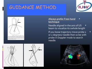 GUIDANCE METHOD

            Always prefer Free-hand 
            technique
            Needle aligned in the axis of US 
            beam to visualize its swhole length
            If you loose trajectory move probe 1   
            or 2 degrees/ needle then scree with
            probe in Doppler mode to search
            needle
 