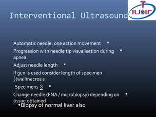 Interventional Ultrasound


Automatic needle: one action movement 
Progression with needle tip visualisation during   
apnea
Adjust needle length 
If gun is used consider length of specimen
((wall/necrosis
 Specimens 3 
Change needle (FNA / microbiopsy) depending on         
tissue obtained
  •Biopsy of normal liver also
 