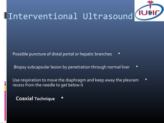 Interventional Ultrasound


Possible puncture of distal portal or hepatic branches   


.Biopsy subcapsular lesion by penetration through normal liver   


Use respiration to move the diaphragm and keep away the pleuram      
recess from the needle to get below it


 Coaxial Technique        
 