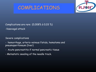 COMPLICATIONS


Complications are rare (0,008% à 0,03 %)
-Vasovagal attack


Severe complications
- hemorrhage, arterio-veinous fistula, hematoma and
pneumoperitoneum (liver)
- Acute pancreatitis if normal pancreatic tissue
- Metastatic seeding of the needle track.
 