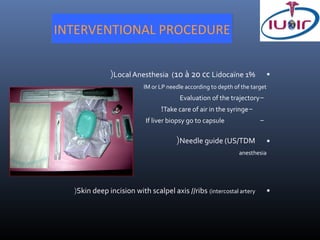 INTERVENTIONAL PROCEDURE


              (Local Anesthesia (10 à 20 cc Lidocaïne 1%                     
                          IM or LP needle according to depth of the target
                                        Evaluation of the trajectory-
                                !Take care of air in the syringe-
                           If liver biopsy go to capsule               -

                                      (Needle guide (US/TDM                  
                                                               anesthesia




  (Skin deep incision with scalpel axis //ribs (intercostal artery           
 