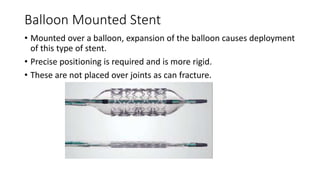 Balloon Mounted Stent
• Mounted over a balloon, expansion of the balloon causes deployment
of this type of stent.
• Precise positioning is required and is more rigid.
• These are not placed over joints as can fracture.
 