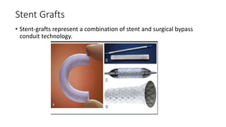 Stent Grafts
• Stent-grafts represent a combination of stent and surgical bypass
conduit technology.
 