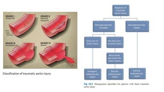 Classification of traumatic aortic injury
 