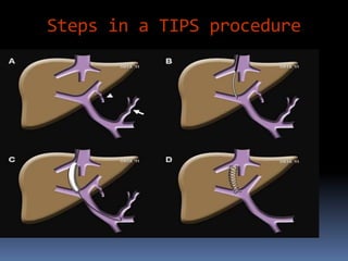 interventionalradiologypart1-170807180227.pdf