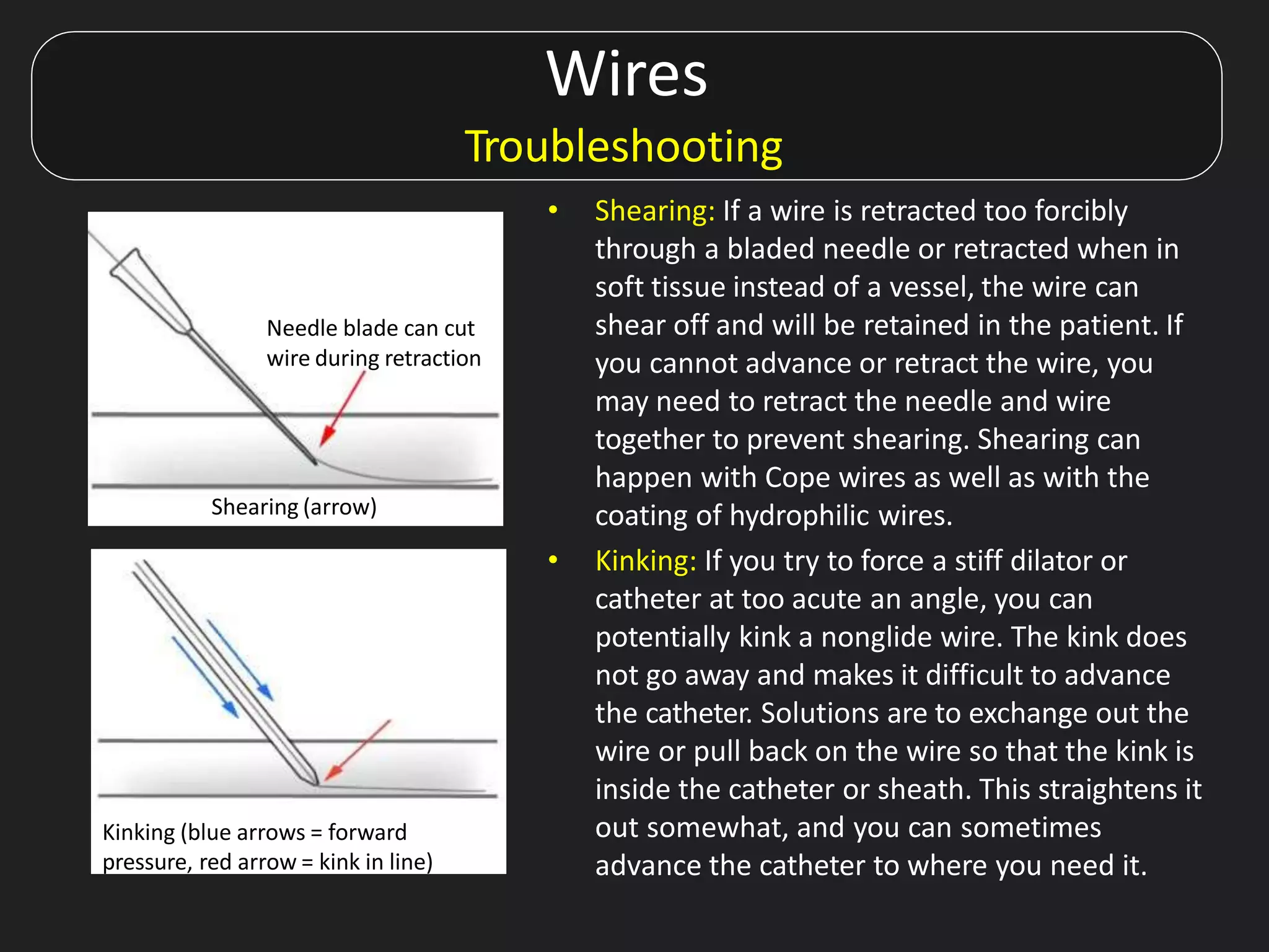 Wires
Troubleshooting
• Shearing: If a wire is retracted too forcibly
through a bladed needle or retracted when in
soft tissue instead of a vessel, the wire can
shear off and will be retained in the patient. If
you cannot advance or retract the wire, you
may need to retract the needle and wire
together to prevent shearing. Shearing can
happen with Cope wires as well as with the
coating of hydrophilic wires.
• Kinking: If you try to force a stiff dilator or
catheter at too acute an angle, you can
potentially kink a nonglide wire. The kink does
not go away and makes it difficult to advance
the catheter. Solutions are to exchange out the
wire or pull back on the wire so that the kink is
inside the catheter or sheath. This straightens it
out somewhat, and you can sometimes
advance the catheter to where you need it.
Shearing (arrow)
Kinking (red arrow) within the vessel lumen
Needle blade can cut
wire during retraction
Kinking (blue arrows = forward
pressure, red arrow = kink in line)
 