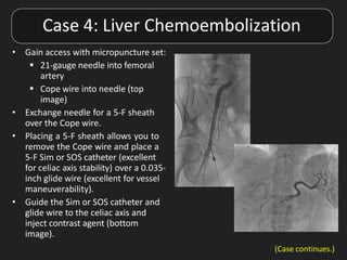 Interventional Radiology Powerpoint.pptx