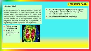 7. GAMMA RAYS
As the wavelengths of electromagnetic waves get
shorter, their energy increases. Gamma rays are the
shortest waves in the spectrum and, as a result, have
the most energy. Gamma rays are sometimes used in
treating cancer and in taking detailed images for
diagnostic medicine. Gamma rays are produced in
high energy nuclear explosions and supernovas.
REFERENCE CARD
This picture is a
“scintigram” 
It shows an
asthmatic person’s
lungs.
The patient was given a slightly radioactive gas to
breath, and the picture was taken using a gamma
camera to detect the radiation.
The colors show the air flow in the lungs.
 