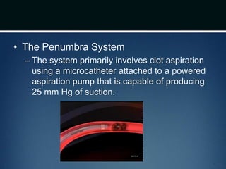 • The Penumbra System
– The system primarily involves clot aspiration
using a microcatheter attached to a powered
aspiration pump that is capable of producing
25 mm Hg of suction.
 