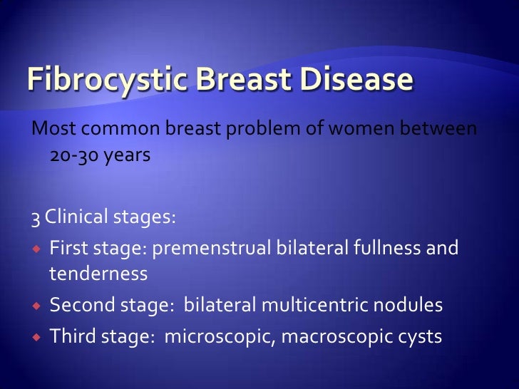 fibrocystic breast changes upper fibrocystic breast changes upper