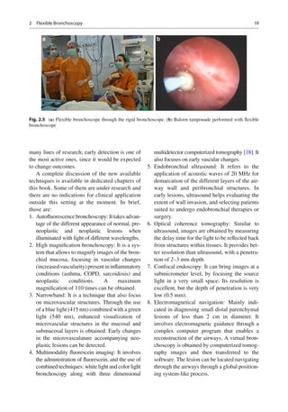 Interventions in pulmonary medicine | PDF