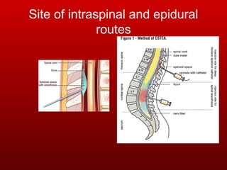 Interventions pain management | PPT