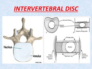 Intervertebral disc prolapese Slide 6