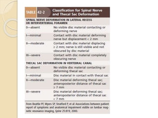 Disc Prolapse Classification Lumbar Intervertebral disc prolapse | PPTX
