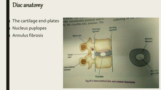 Disc anatomy
■ The cartilage end-plates
■ Nucleus puplopes
■ Annulus fibrosis
 