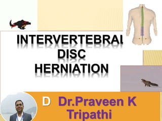 INTERVERTEBRAL
DISC
HERNIATION
D Dr.Praveen K
Tripathi
 