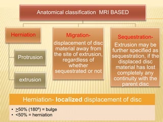 Disc Prolapse Classification Inter vertebral disc prolapse | PPTX