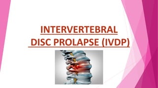 INTERVERTEBRAL
DISC PROLAPSE (IVDP)
 