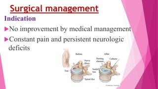 Surgical management
Indication
No improvement by medical management
Constant pain and persistent neurologic
deficits
 