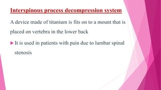 Interspinous process decompression system
A device made of titanium is fits on to a mount that is
placed on vertebra in the lower back
 It is used in patients with pain due to lumbar spinal
stenosis
 