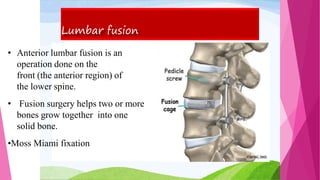 Lumbar fusion
• Anterior lumbar fusion is an
operation done on the
front (the anterior region) of
the lower spine.
• Fusion surgery helps two or more
bones grow together into one
solid bone.
•Moss Miami fixation
 