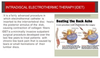 INTRADISCAL ELECTROTHERMIC THERAPY(IDET)
heats
It is a fairly advanced procedure in
which electrothermal catheter is
inserted to the intervertebral disc
the posterior annulus of the disk,
causing contraction of collagen fibers
IDET is a minimally invasive outpatient
surgical procedure developed over the
last few years to treat patients with
chronic low back pain that is caused by
tears or small herniations of their
lumbar discs.
 