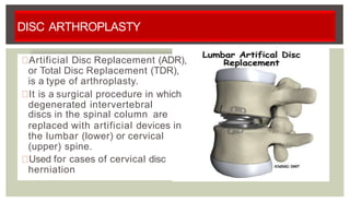 DISC ARTHROPLASTY
Artificial Disc Replacement (ADR),
or Total Disc Replacement (TDR),
is a type of arthroplasty.
It is a surgical procedure in which
degenerated intervertebral
discs in the spinal column are
replaced with artificial devices in
the lumbar (lower) or cervical
(upper) spine.
Used for cases of cervical disc
herniation
 