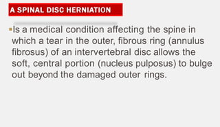 Is a medical condition affecting the spine in
which a tear in the outer, fibrous ring (annulus
fibrosus) of an intervertebral disc allows the
soft, central portion (nucleus pulposus) to bulge
out beyond the damaged outer rings.
 